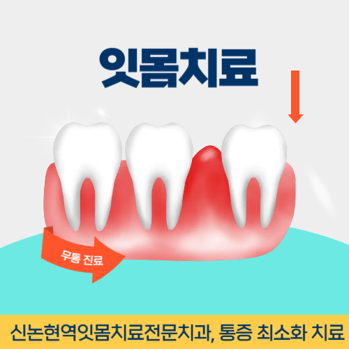 동해치과 동해시 치과 잇몸치료
